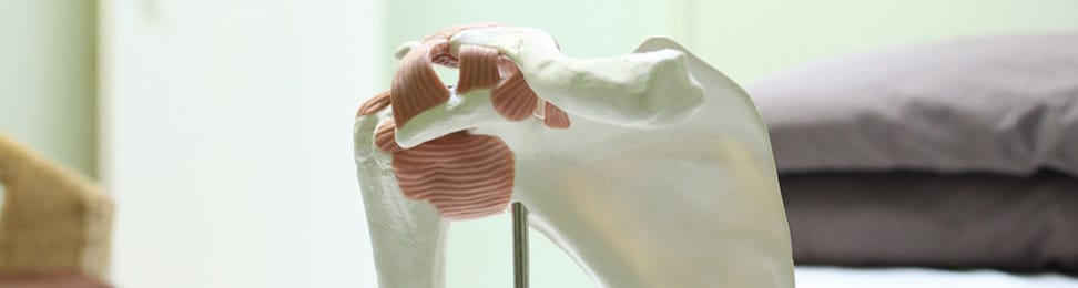 Acupuncture and Physiotherapy