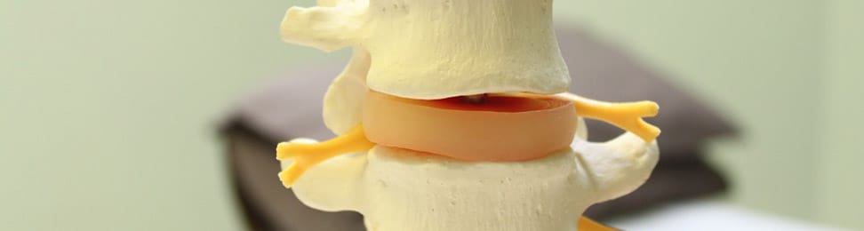 Acupuncture and Physiotherapy